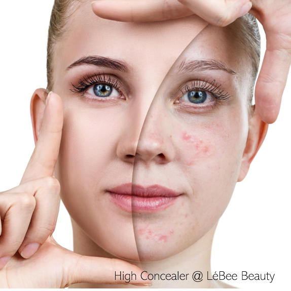 HIGH COVERAGE CONCEALER KIT
